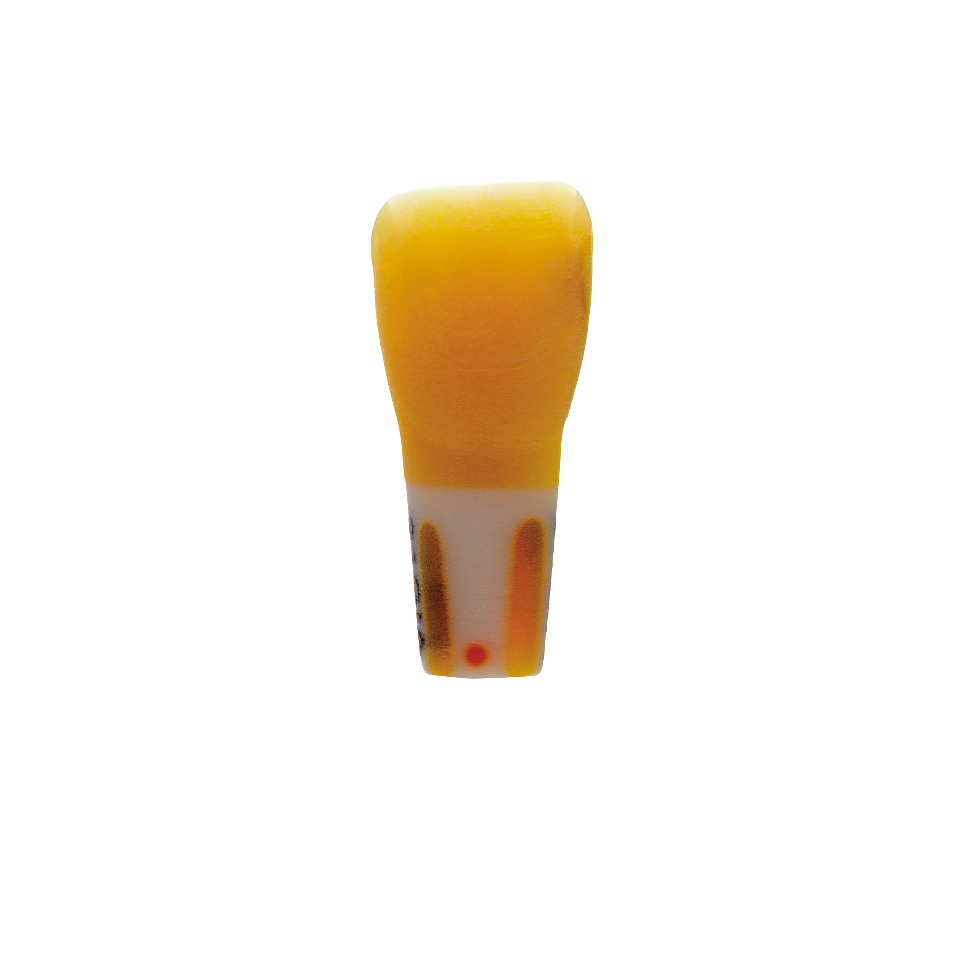 myteeth training tooth 21, mesial class III GIZ filling