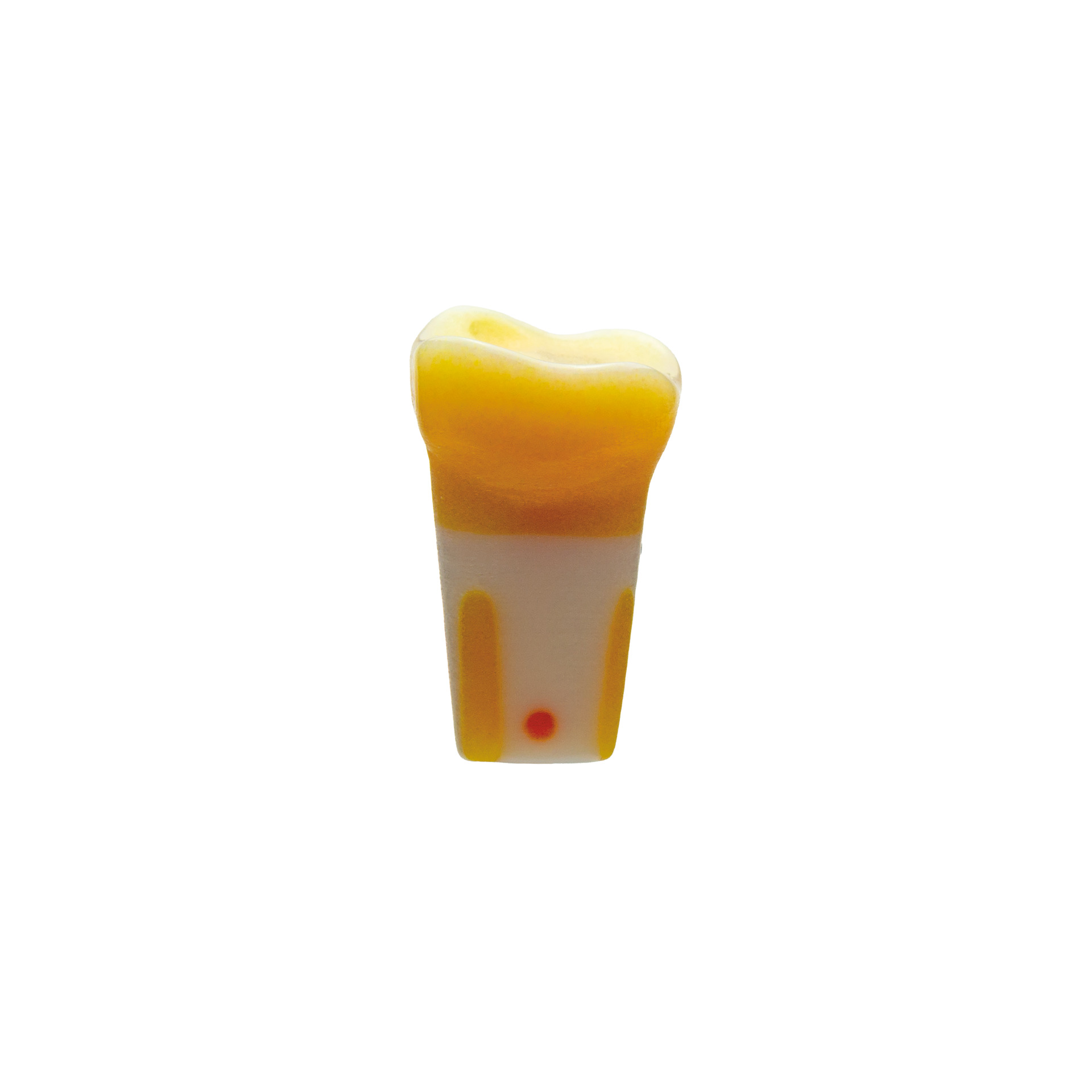 myteeth training tooth 16, with occlusal veneer / table-top preparation