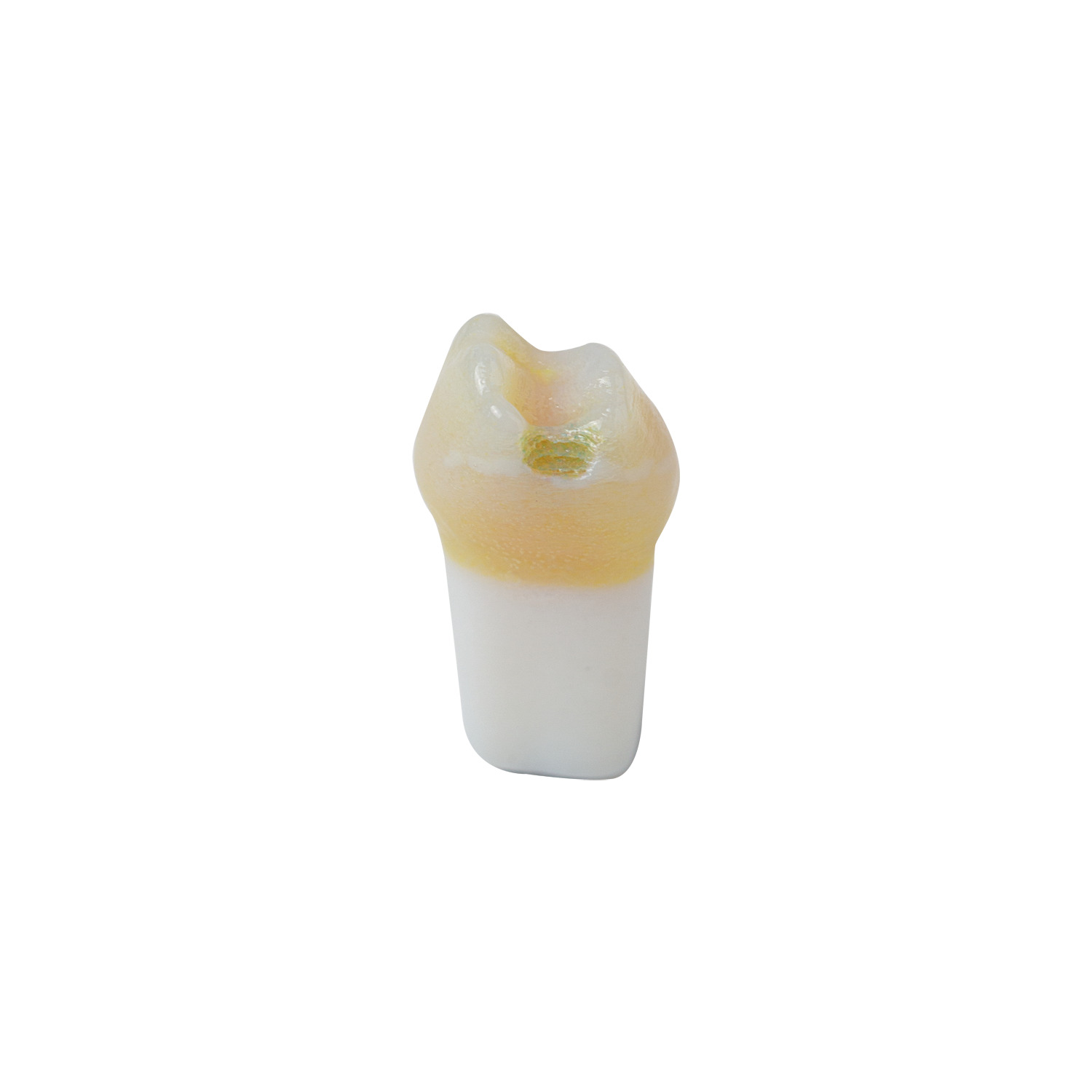 produkt 4d zahn ak 6 2 milchmolar 54 kavitaet mit karies okklusal distal