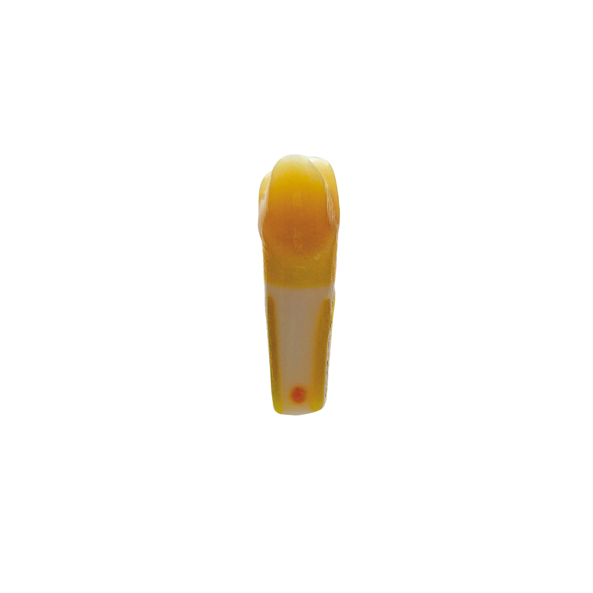 myteeth training tooth 24, with partial veneer and vestibular chamfer preparation with isthmus
