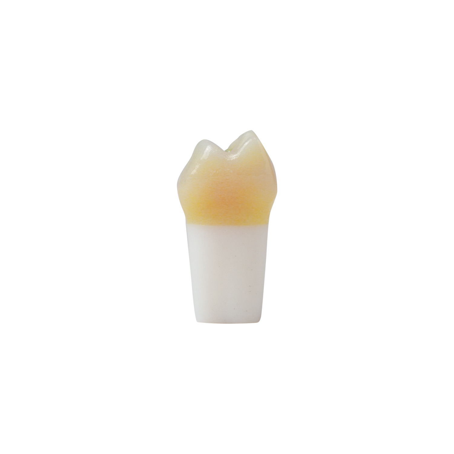 produkt 4d zahn ak 6 2 milchmolar 54 kavitaet mit karies okklusal distal