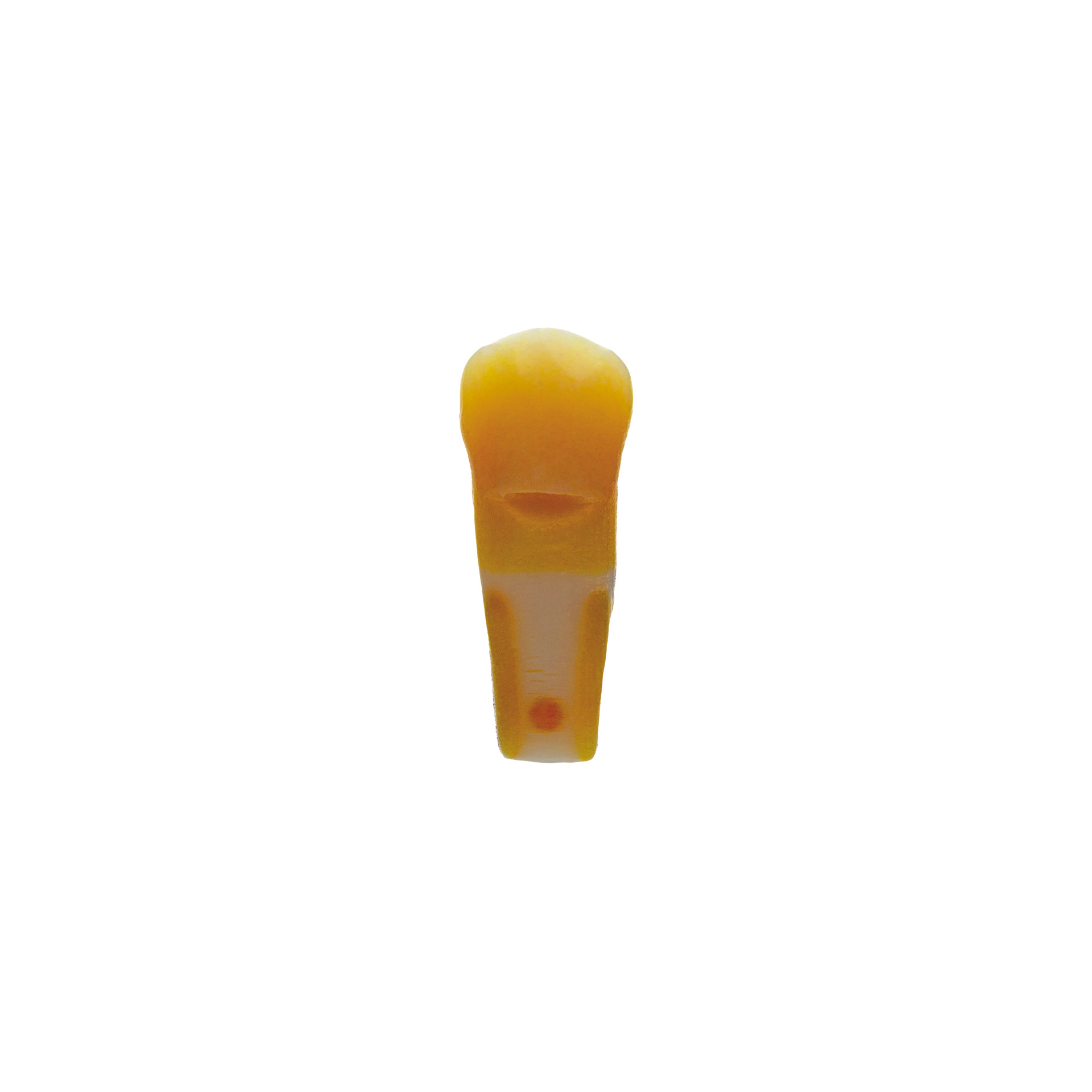 myteeth training tooth 34, with occlusal veneer / table top preparation and cervical enamel defect Jaw model: ANA-4