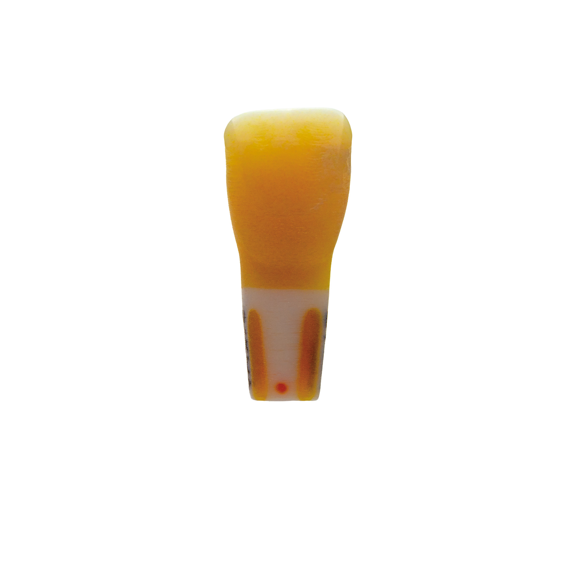 myteeth training tooth 21, with fully anatomical caries defect