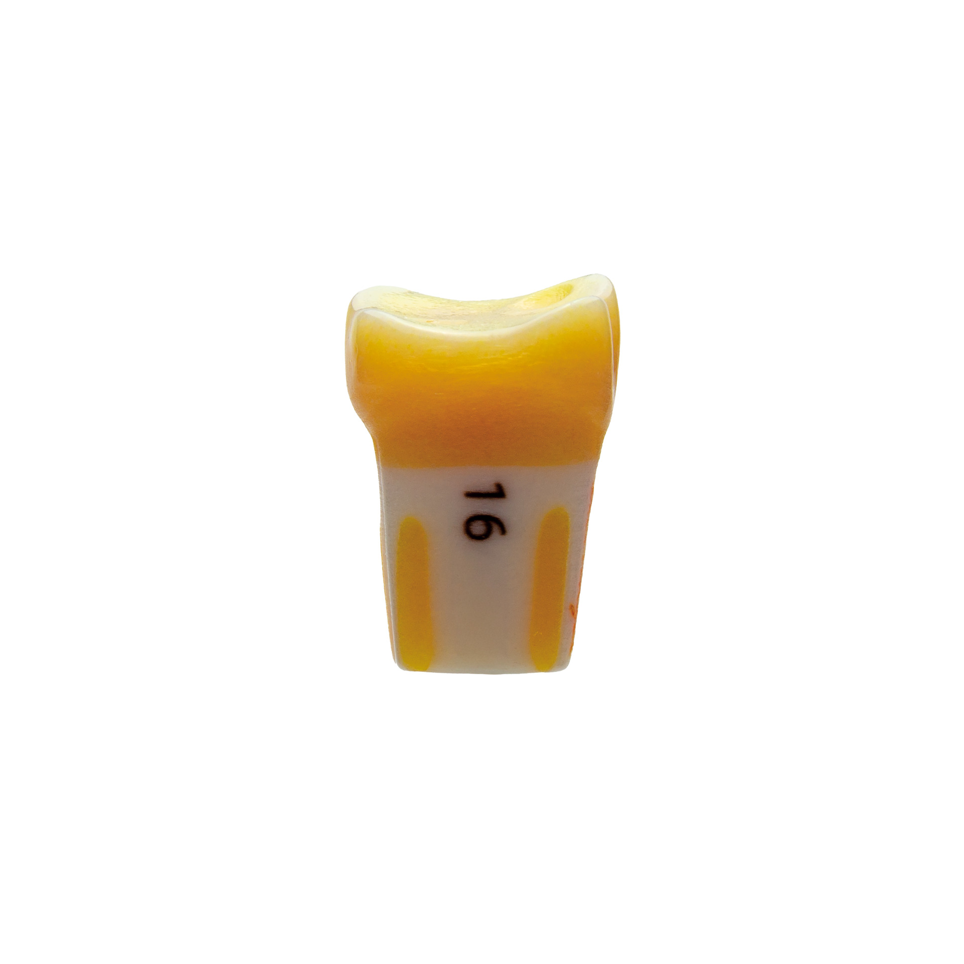 myteeth Übungszahn 16, mit okklusaler Veneer / Table- Top Präparation