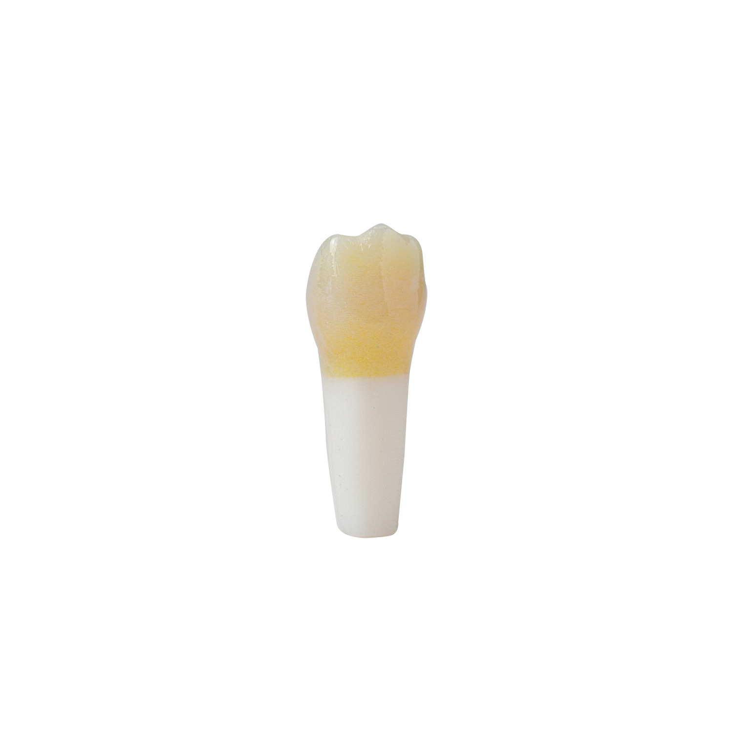 produkt 4d zahn ak 6 2 milchmolar 54 kavitaet mit karies okklusal distal