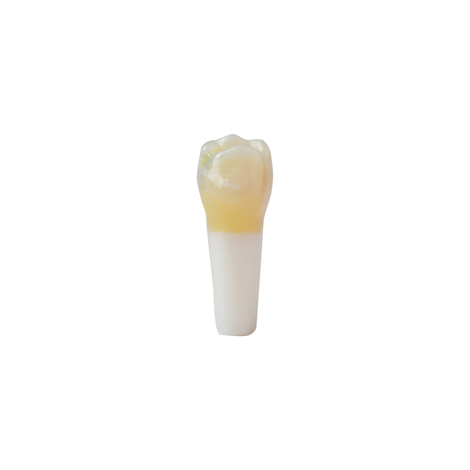 produkt 4d zahn ak 6 2 milchmolar 54 kavitaet mit karies okklusal distal