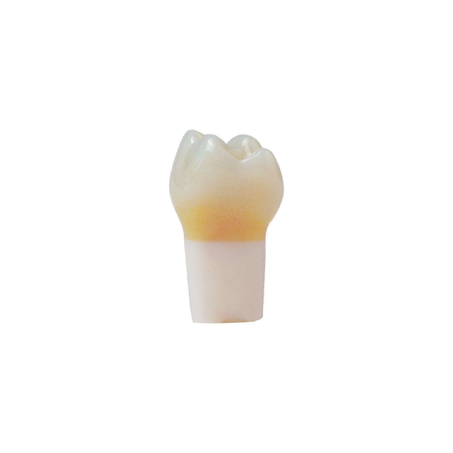 produkt 4d zahn ak 6 16 mz okklusalkaries mit cp