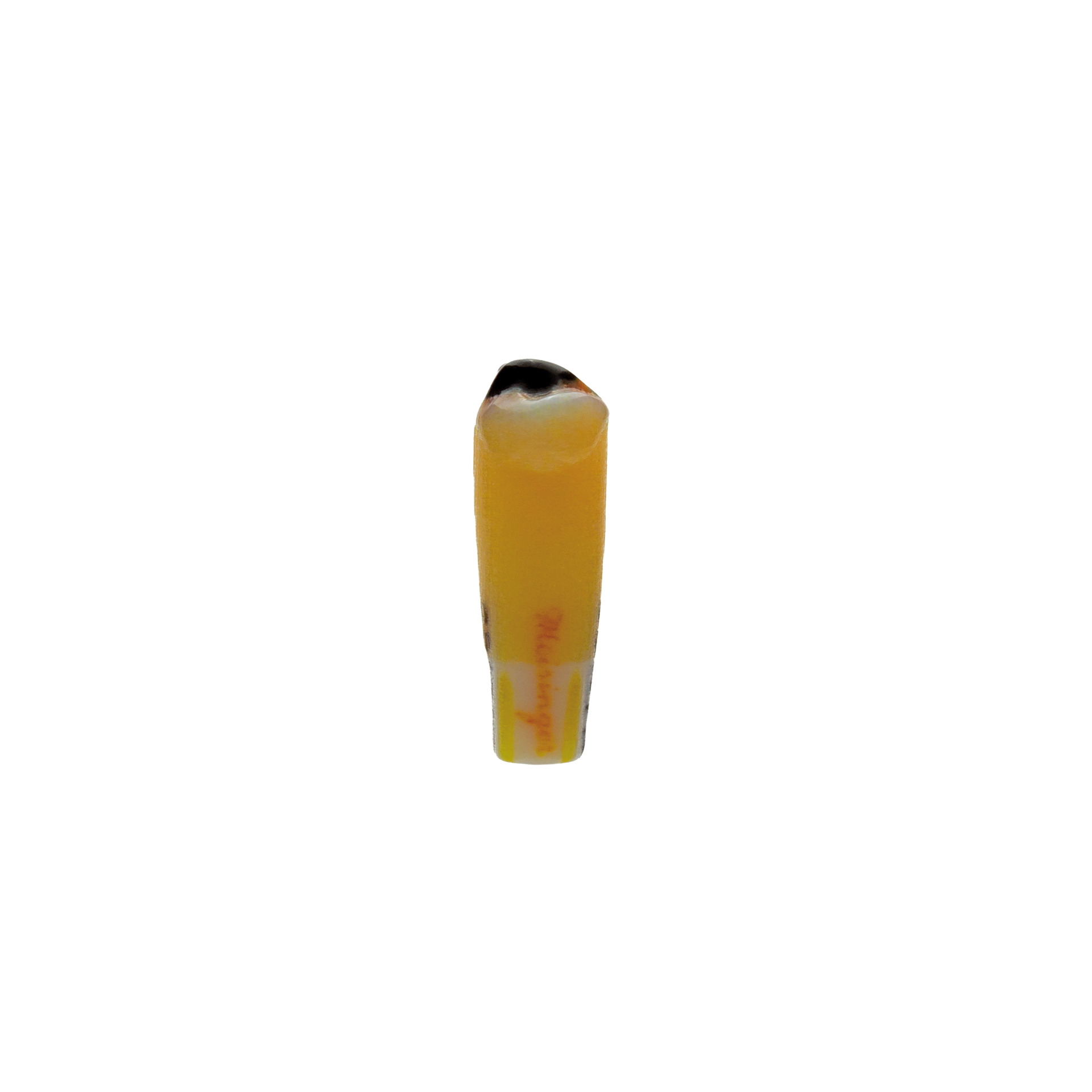 myteeth training tooth 25 largely coronal degree of destruction, WF sufficient Jaw model: ANKA-4