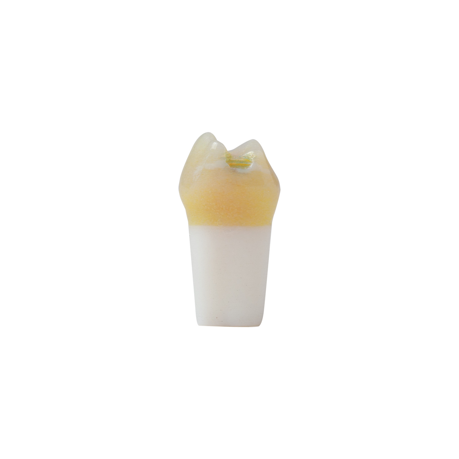 produkt 4d zahn ak 6 2 milchmolar 54 kavitaet mit karies okklusal distal