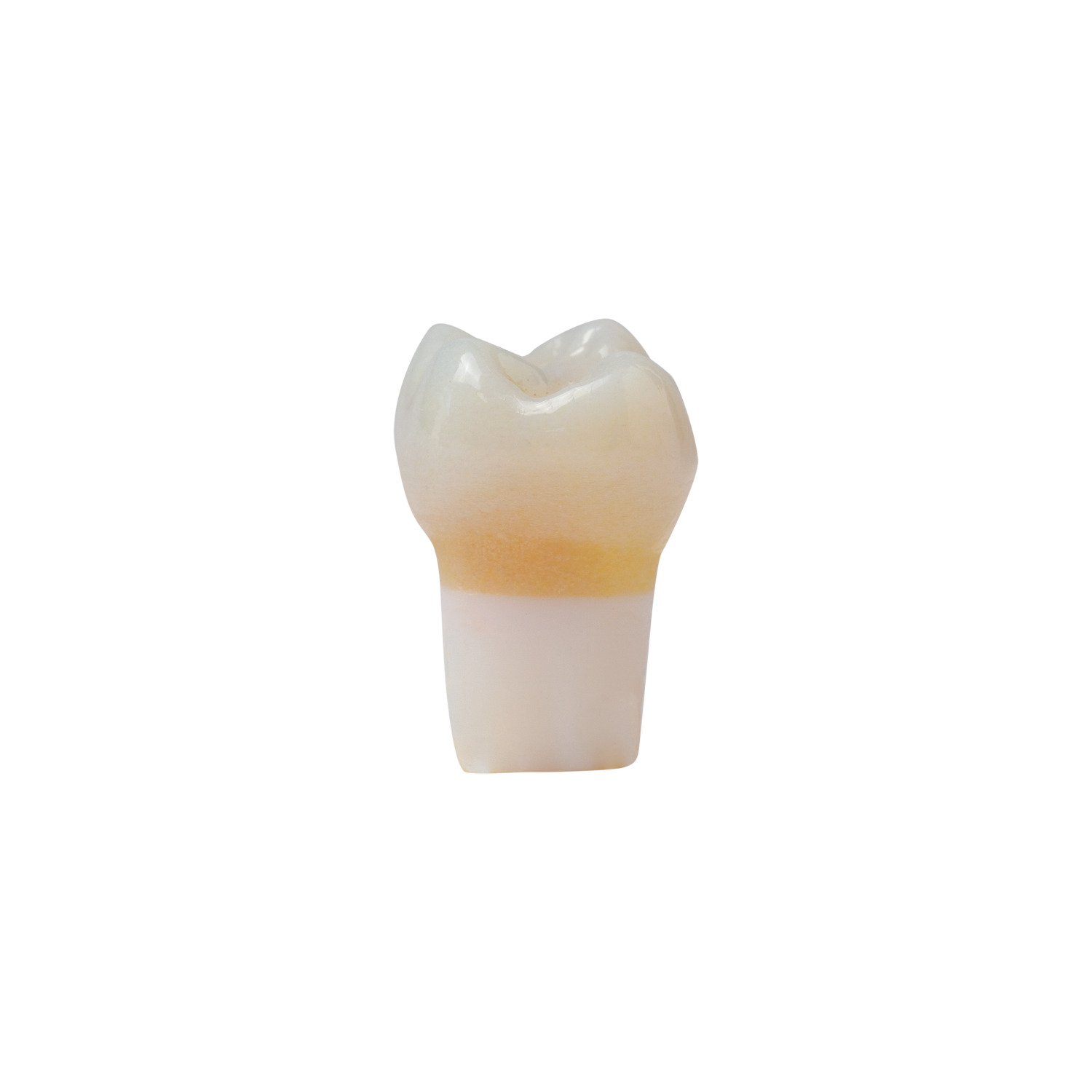 produkt 4d zahn ak 6 55mz okklusalkaries mit cp
