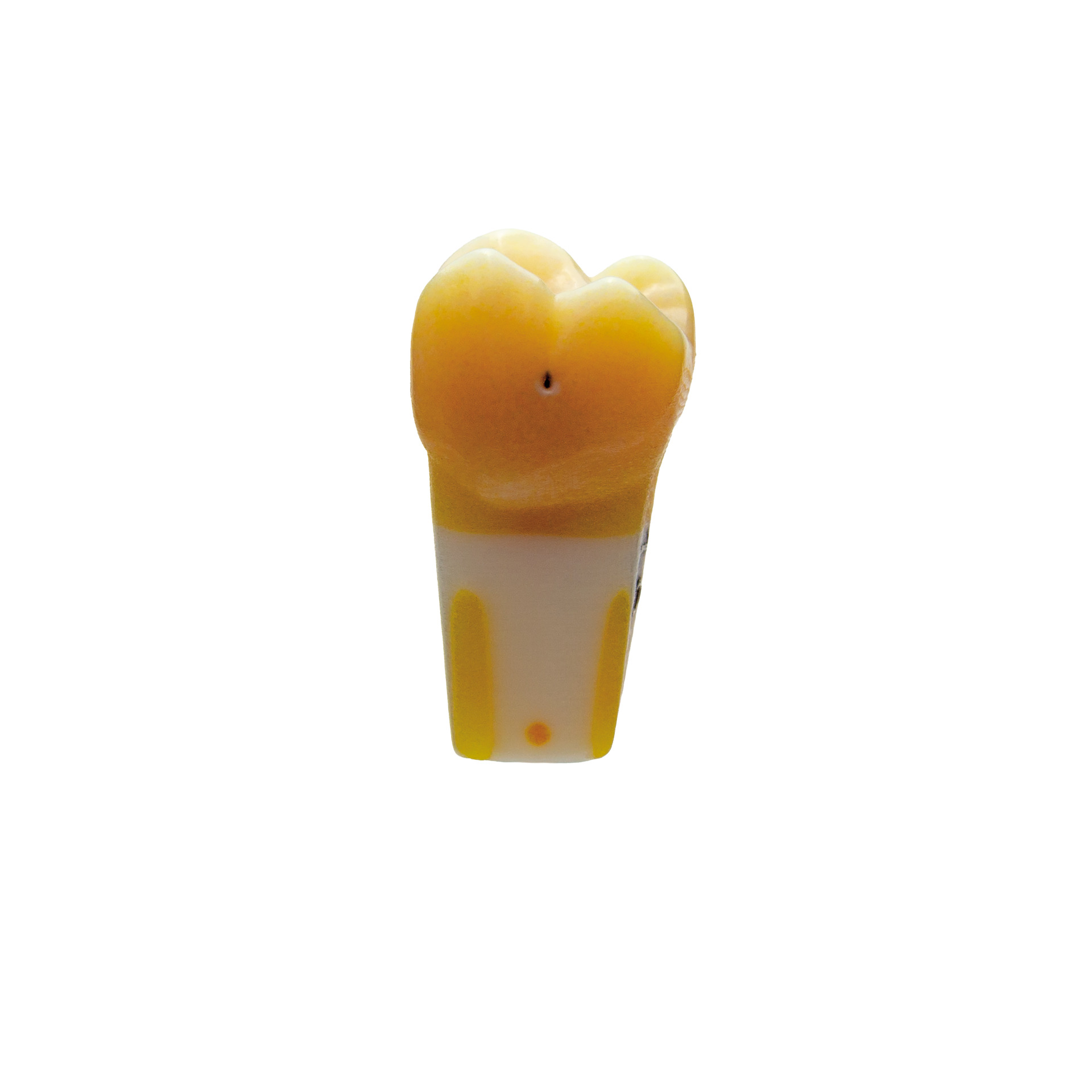 myteeth training tooth 16, fissure caries