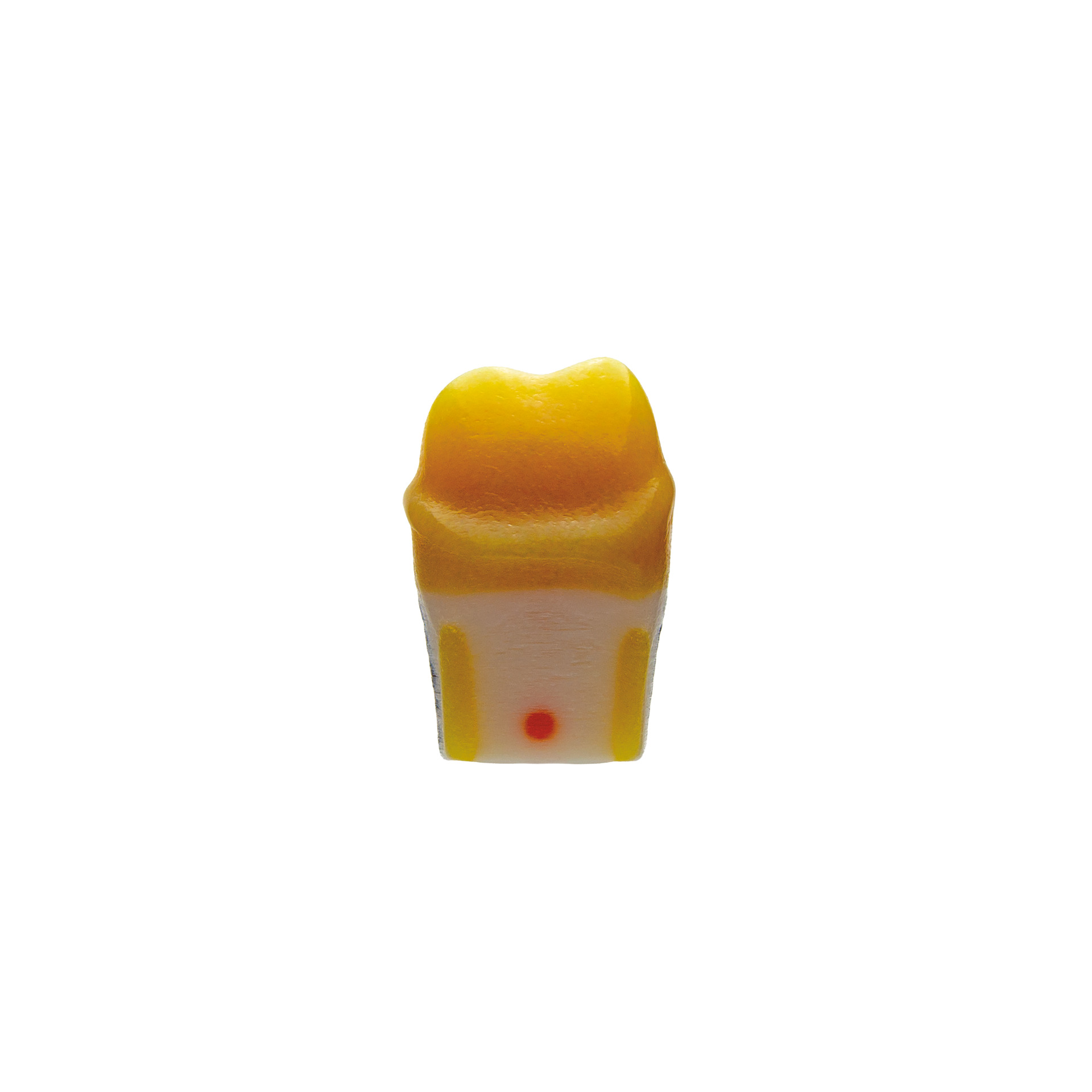 myteeth training tooth 46, with circumferential chamfer preparation Jaw model: ANA-4