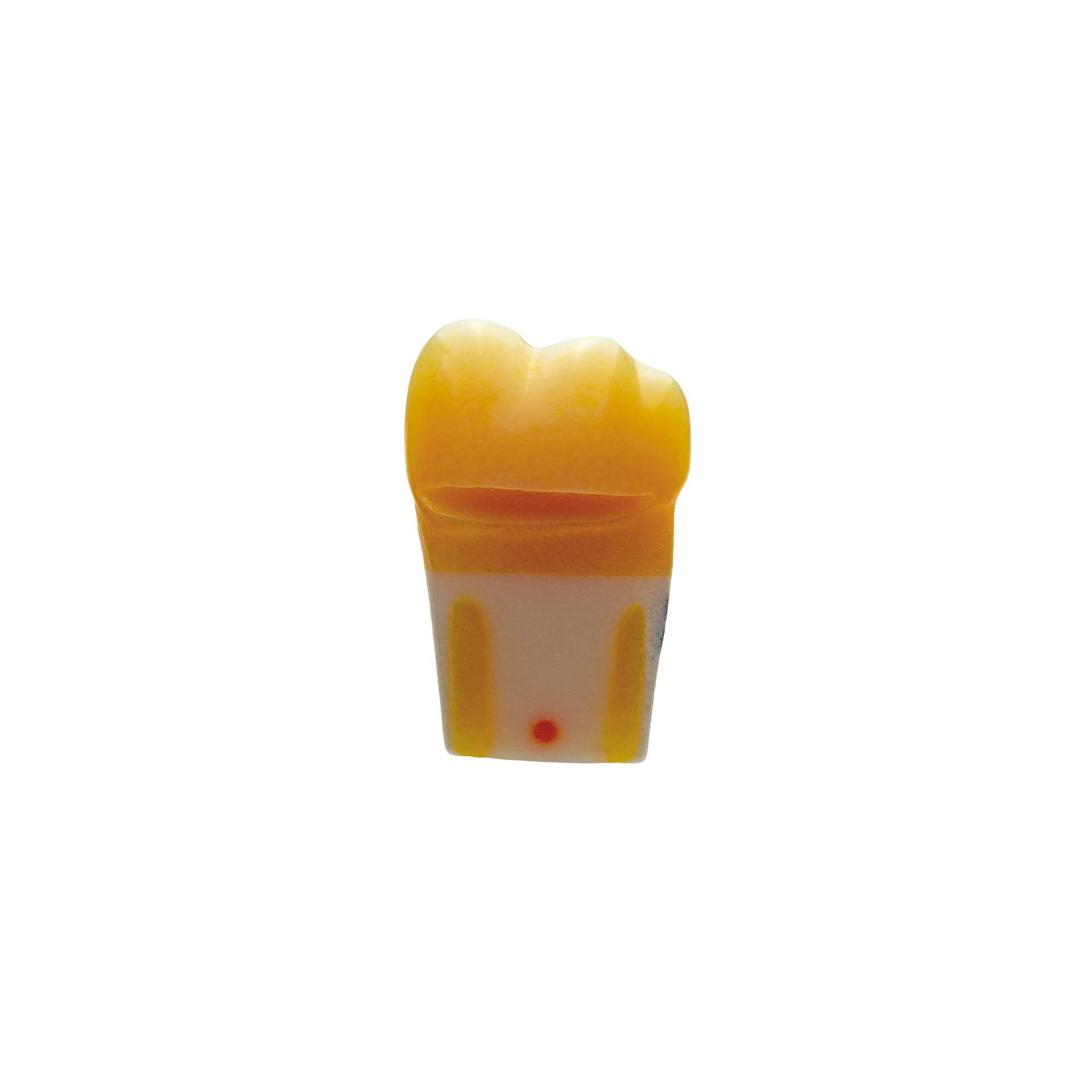 myteeth training tooth 36, with MOD inlay preparation and cervical enamel defect Jaw model: ANA-4