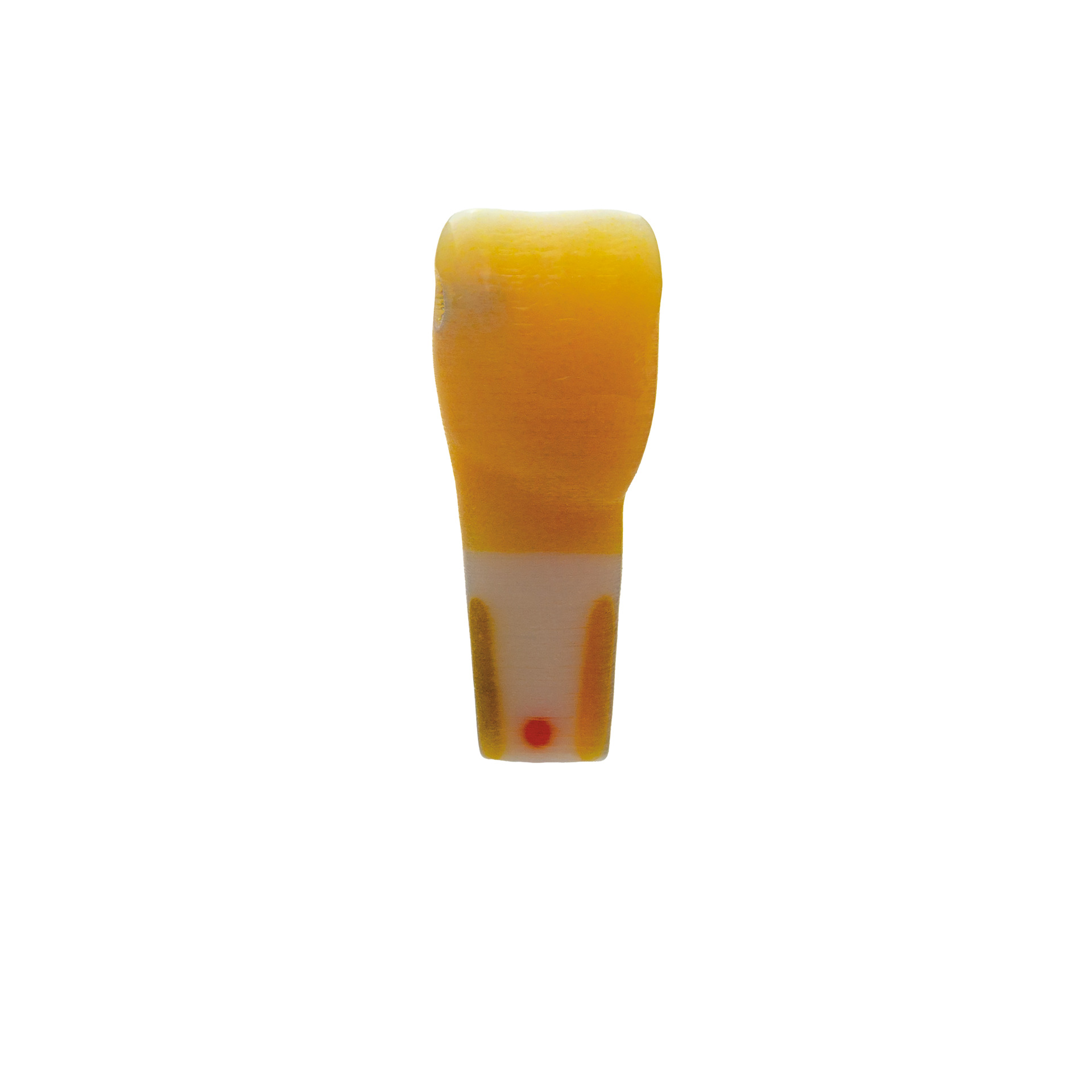 myteeth training tooth 11, mesial approximal caries and distorotation