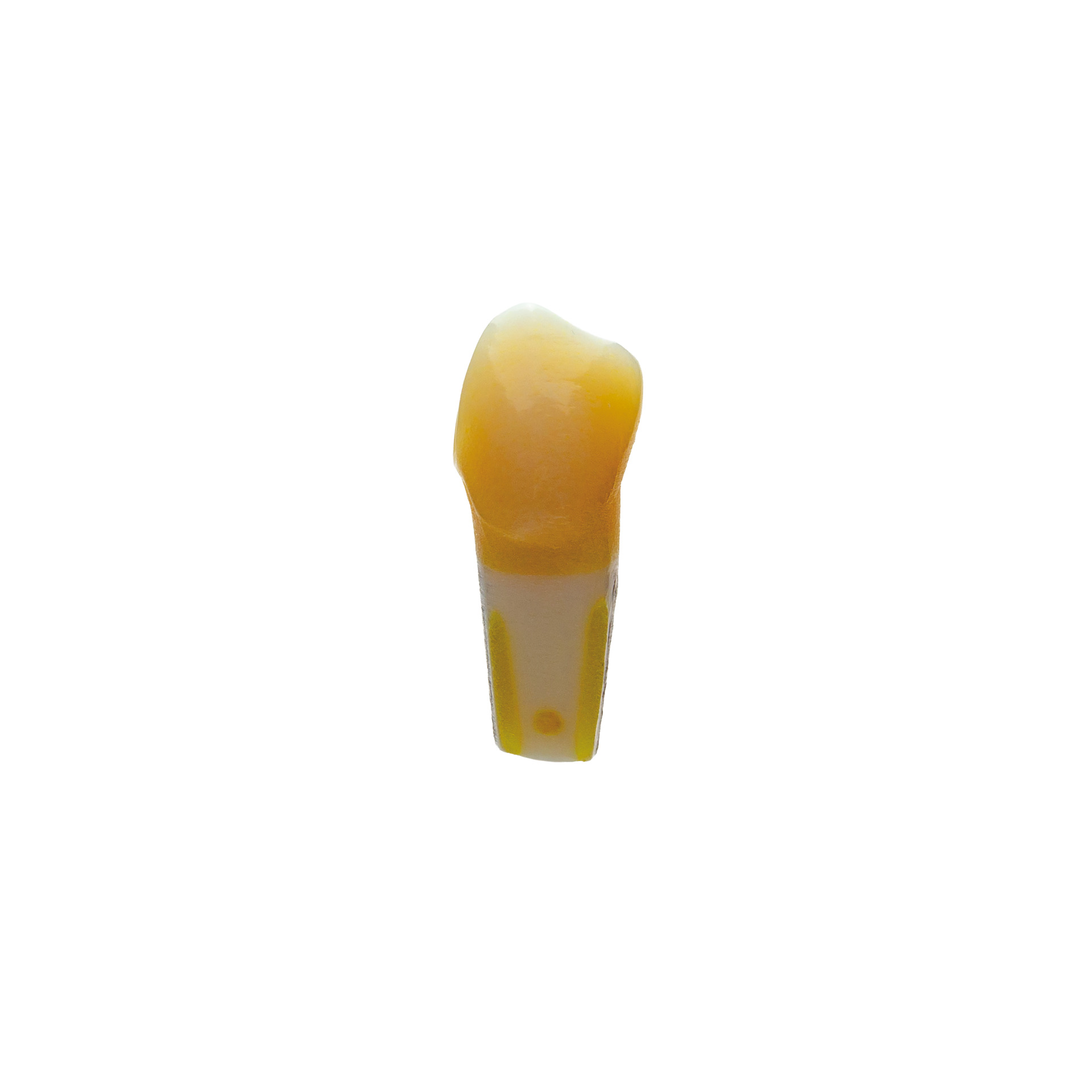 myteeth training tooth 35, with MO inlay preparation Jaw model: ANA-4