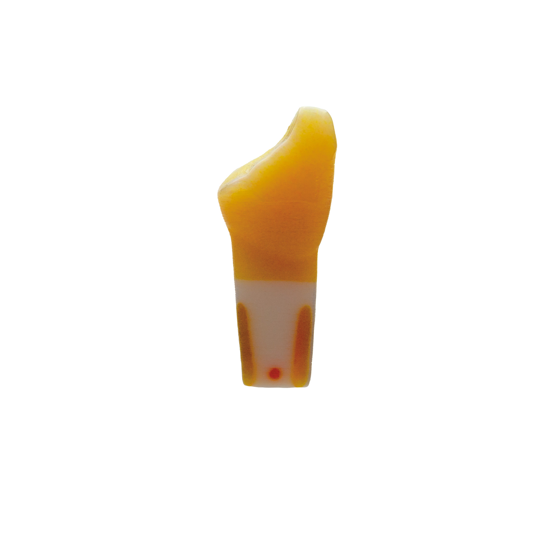 myteeth training tooth 11, with anterior fracture