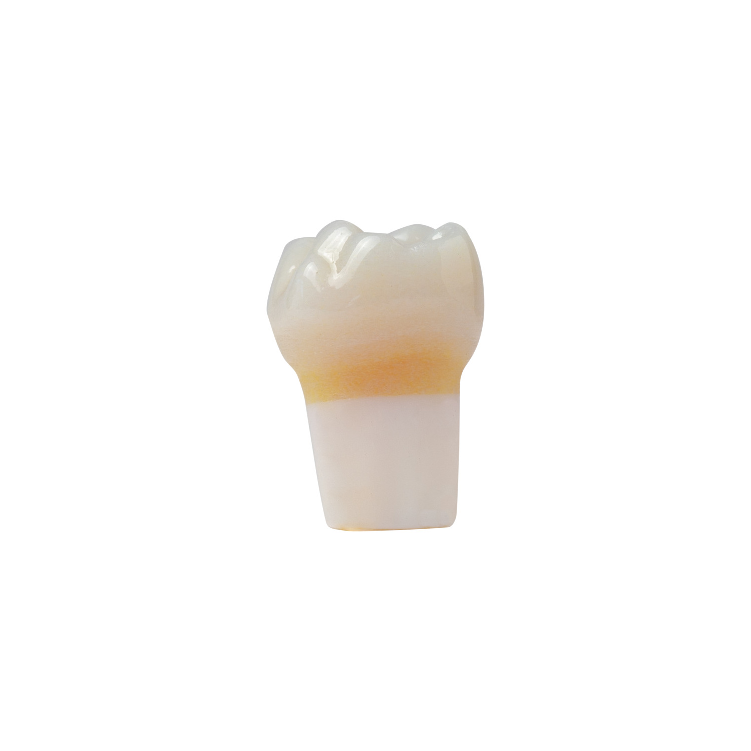 produkt 4d zahn ak 6 55mz okklusalkaries mit cp