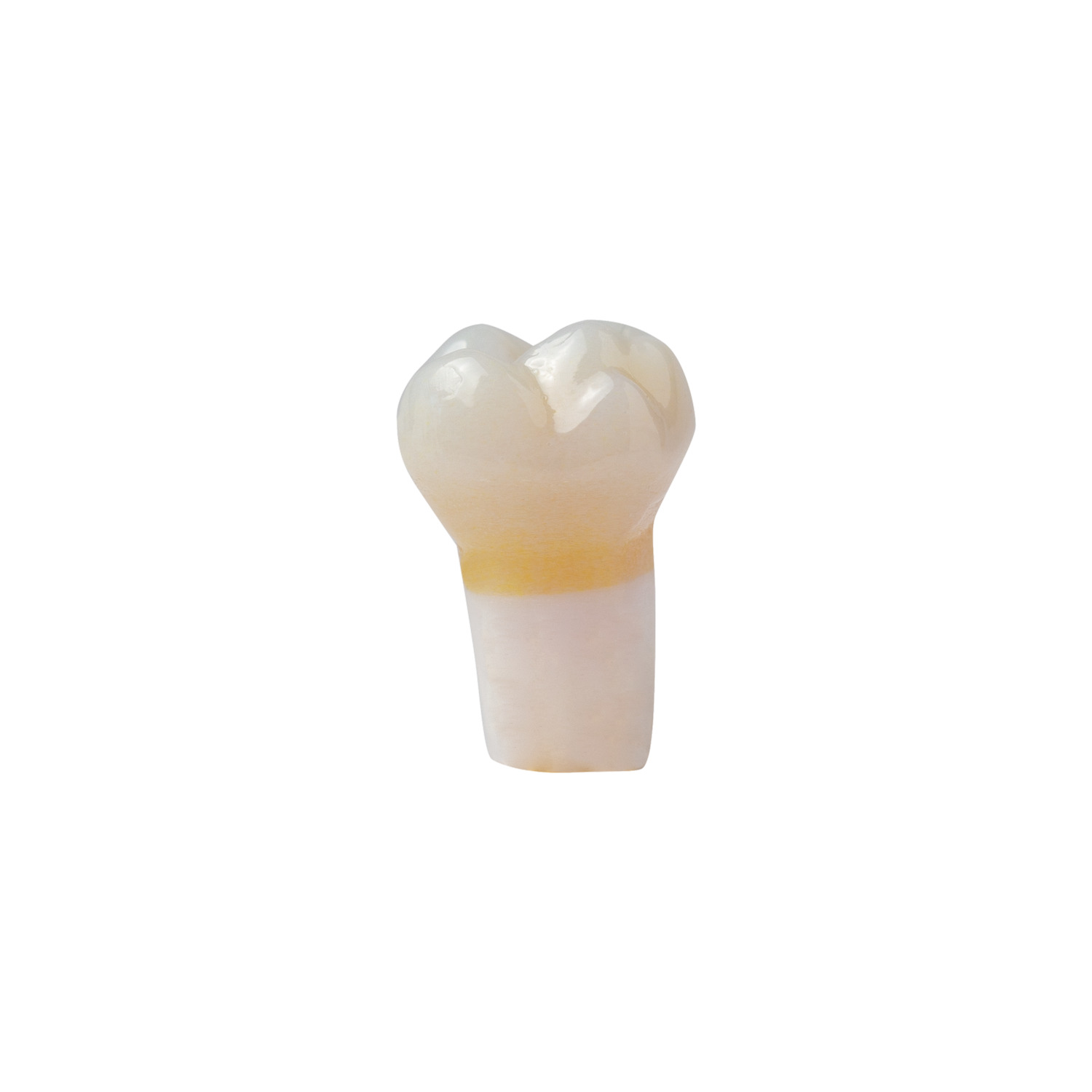 produkt 4d zahn ak 6 55mz okklusalkaries mit cp